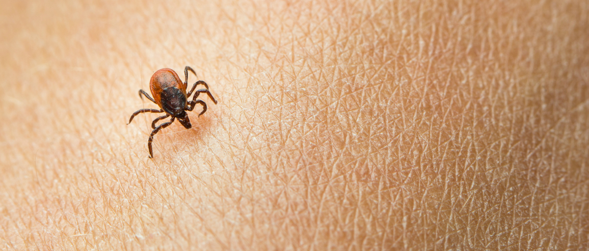What should you do if you get a tick bite?