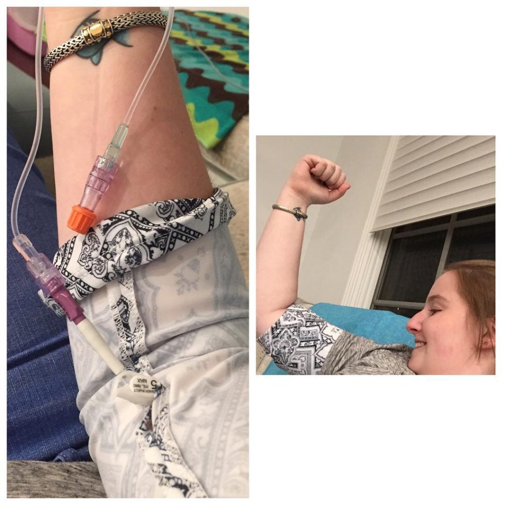 Sara wearing the PICCPerfect® PICC Line Cover (Version 1) to cover her PICC